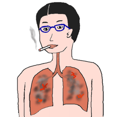 喫煙で肺がんになった絵（イラスト）