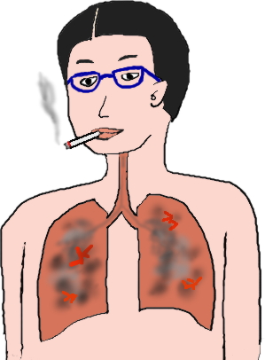 喫煙で肺がんになった絵（イラスト）